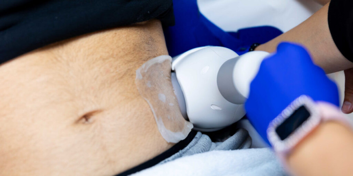 Can CoolSculpting Improve Body Confidence and Shape?