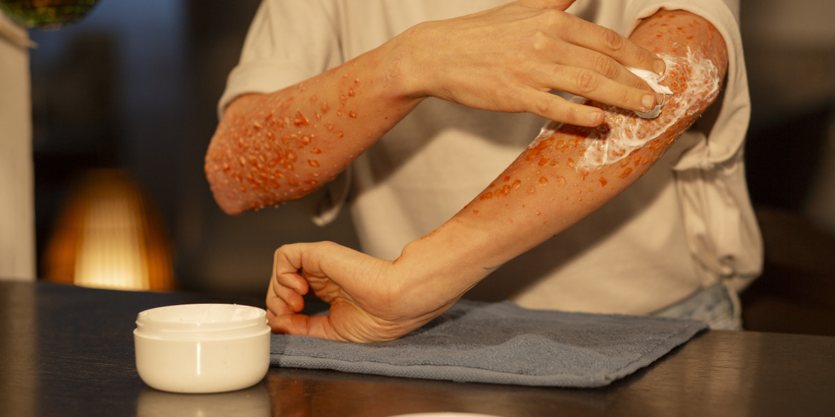 Ivermectin 3mg: Effective Uses in Treating Parasitic Infections