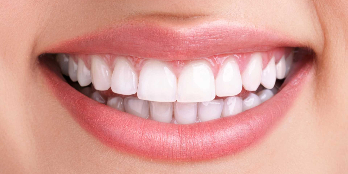 How Age Impacts Your Teeth Whitening Cost Over Time