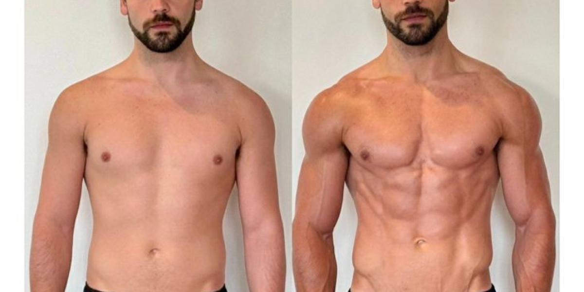 How to Prepare for Gynecomastia Surgery in Riyadh for Best Results