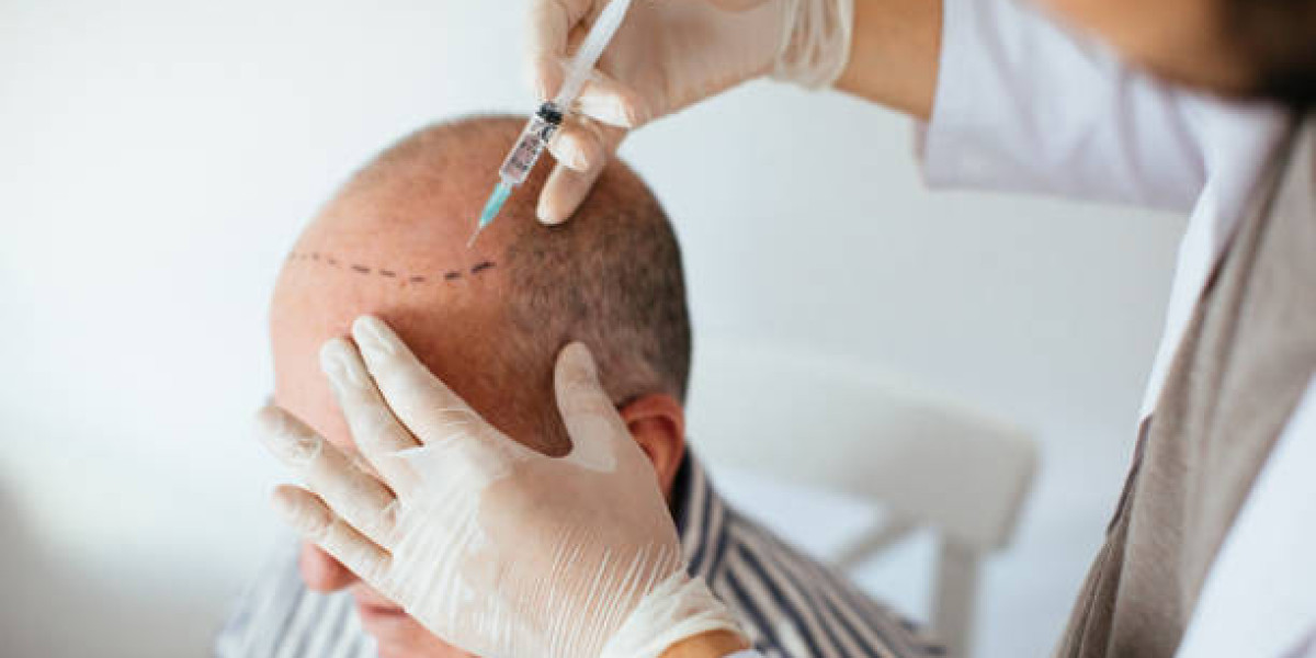 نصائح ما بعد زراعة الشعر في الرياض