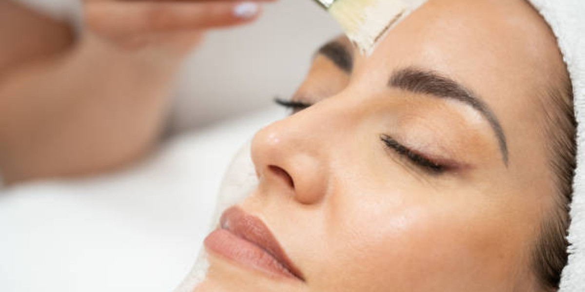 Chemical Peels in Riyadh for Smooth and Even Skin Tone