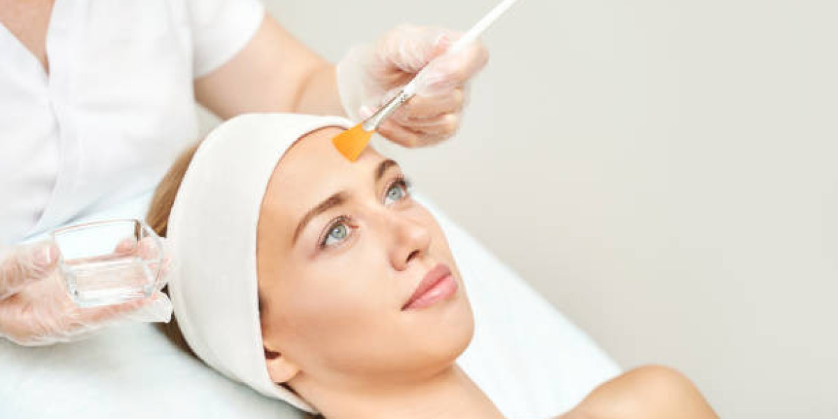 The Science Behind Chemical Peels in Riyadh and Skin Care Benefits