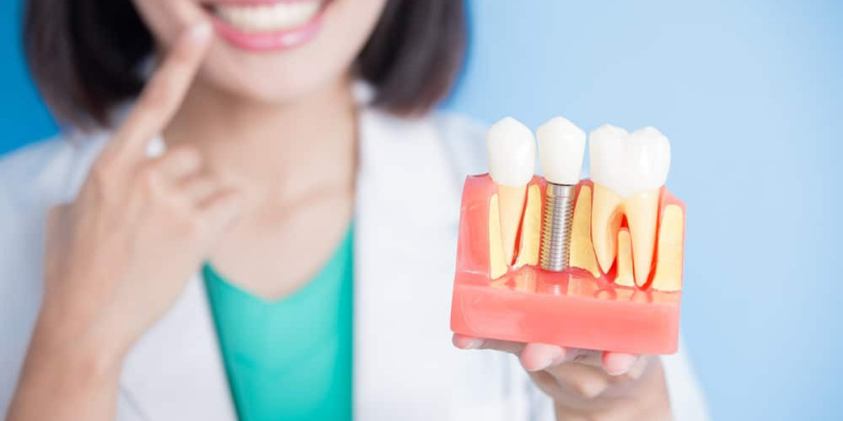 Claim Your Smile Crown with Dental Implants Dubai Support
