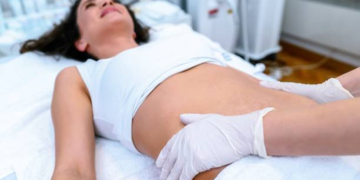 Common Myths and Facts About Liposuction Debunked