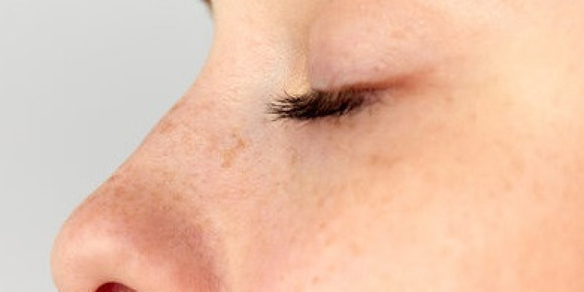 The Art and Precision of Rhinoplasty in Islamabad
