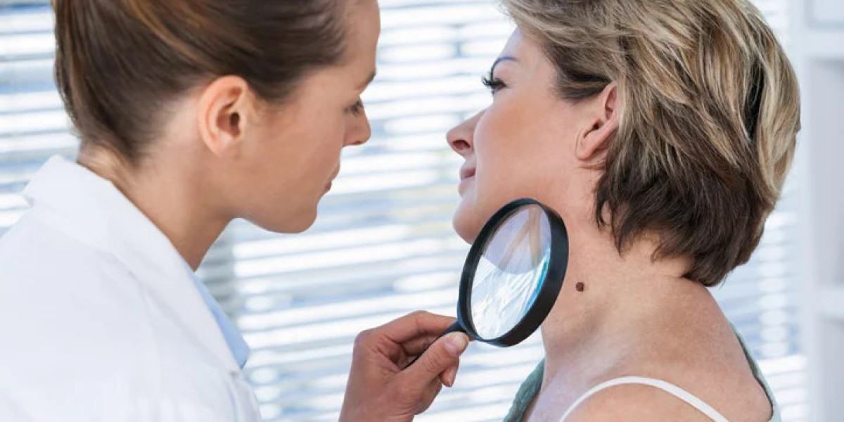 What the Best Dermatologist Does for Hormonal Acne Relief