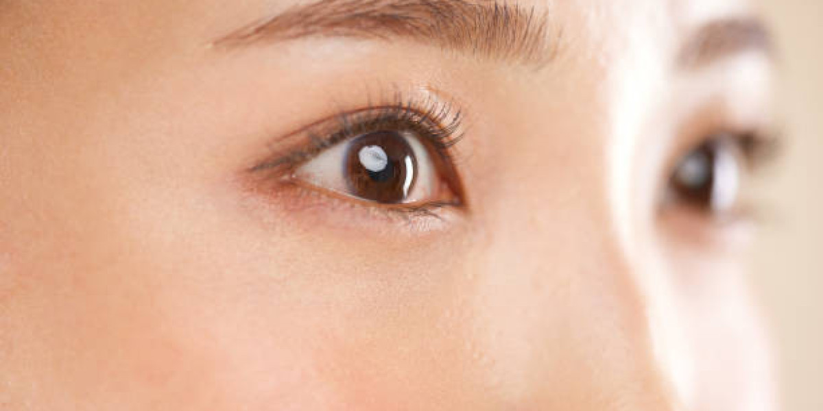Eyelid Surgery in Riyadh: What to Expect Before and After