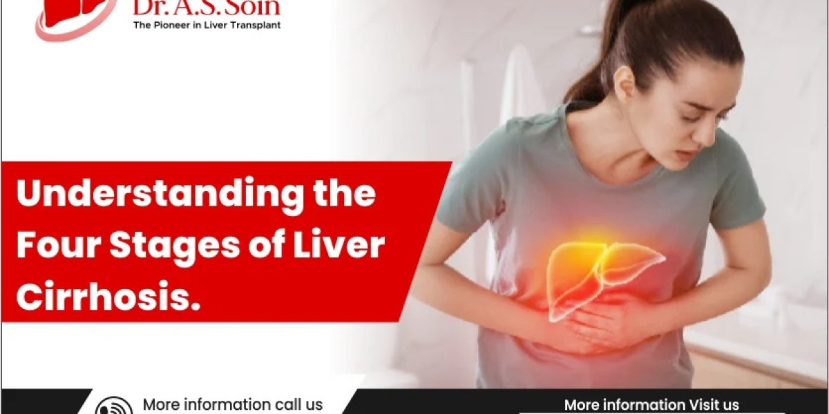 Understanding The Four Stages Of Liver Cirrhosis