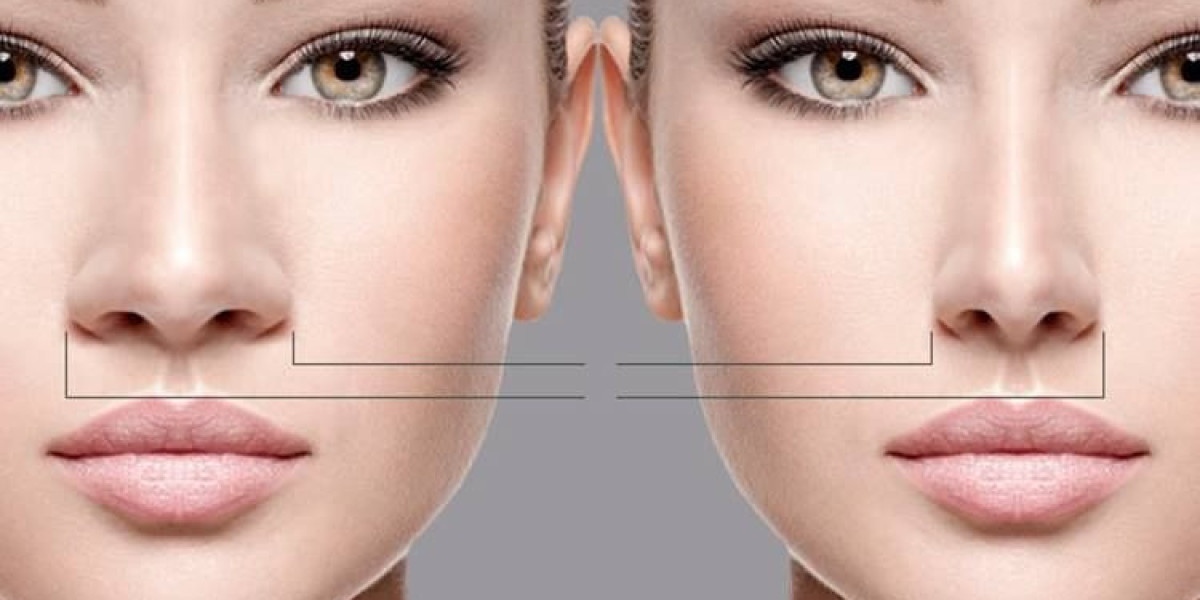 Revision Rhinoplasty in Riyadh – Correcting Previous Surgeries