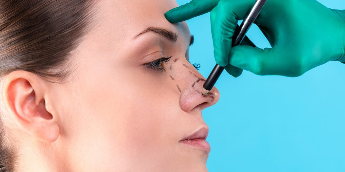 Open vs. Closed Rhinoplasty – Islamabad Surgeons Explain the Difference