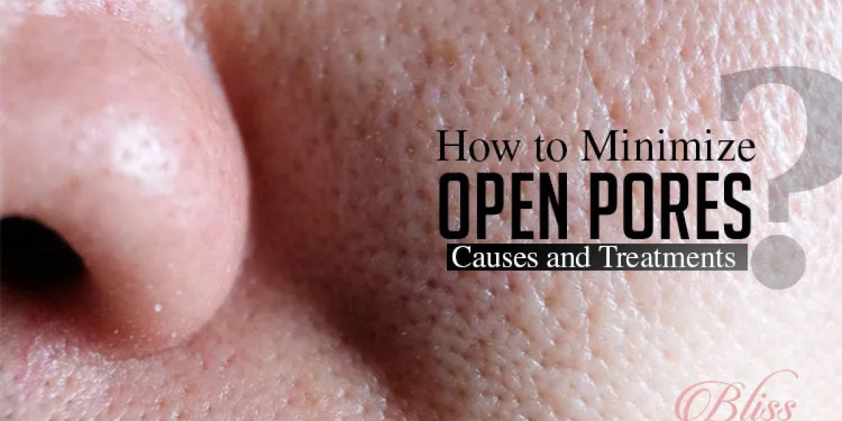 How to Minimize Open Pores: Causes and Treatments Best Dermatologist in Ludhiana