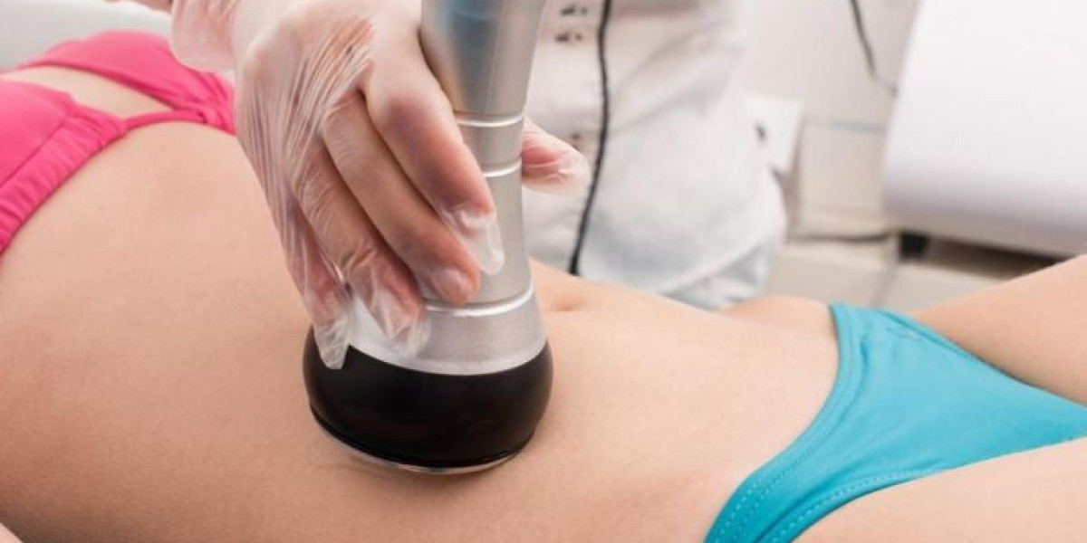Laser Liposuction Treatment Riyadh