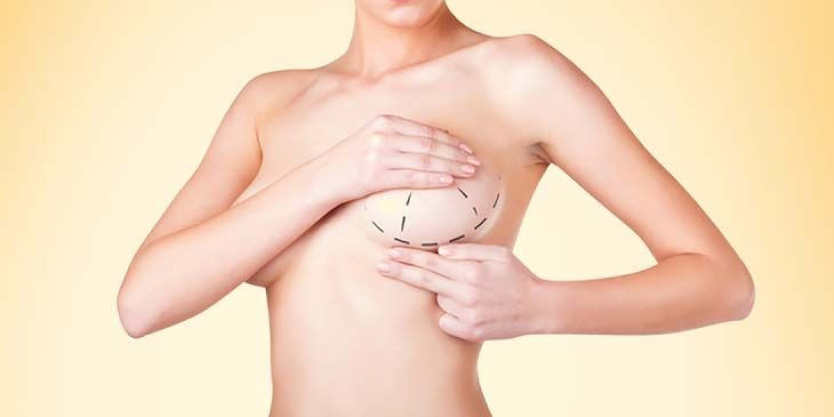Breast Augmentation in Dubai & Tummy Tuck in Dubai by Dr. Hans Plastic Surgeon