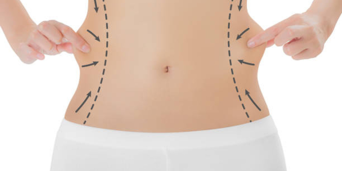 Lipo Abdominoplasty in Riyadh: Best Practices for Stunning Contours