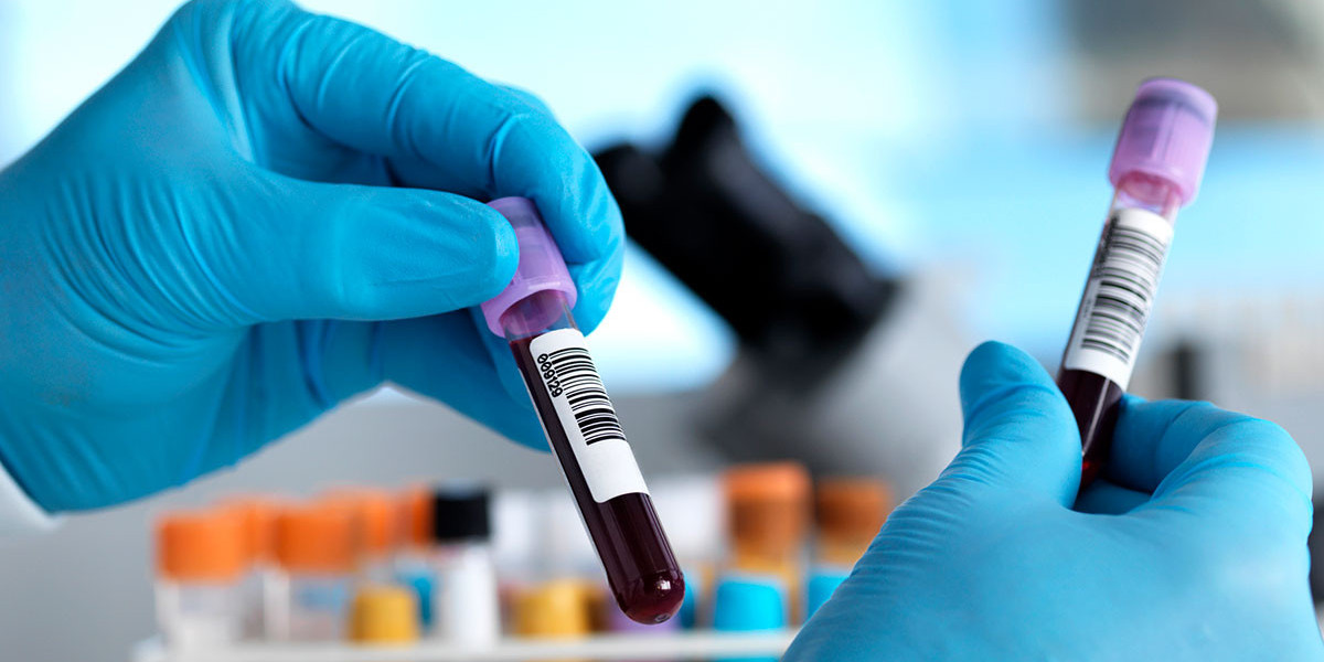 Track Your Vital Health Markers with Blood Test at Home