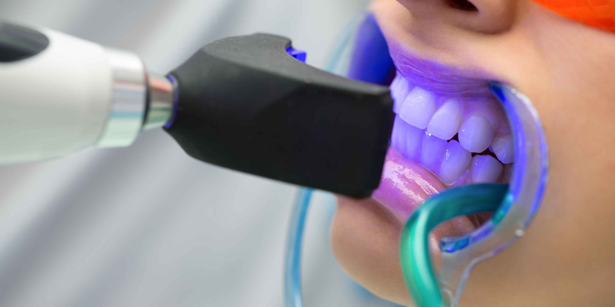 Best Dental Clinics for Teeth Whitening in Islamabad