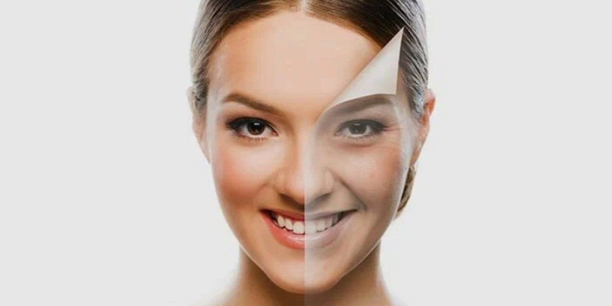 Skin Whitening Laser Treatments in Islamabad: What to Expect