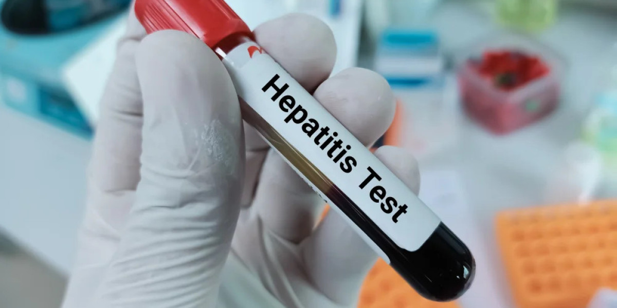 Can Blood Test at Home Detect Hepatitis?