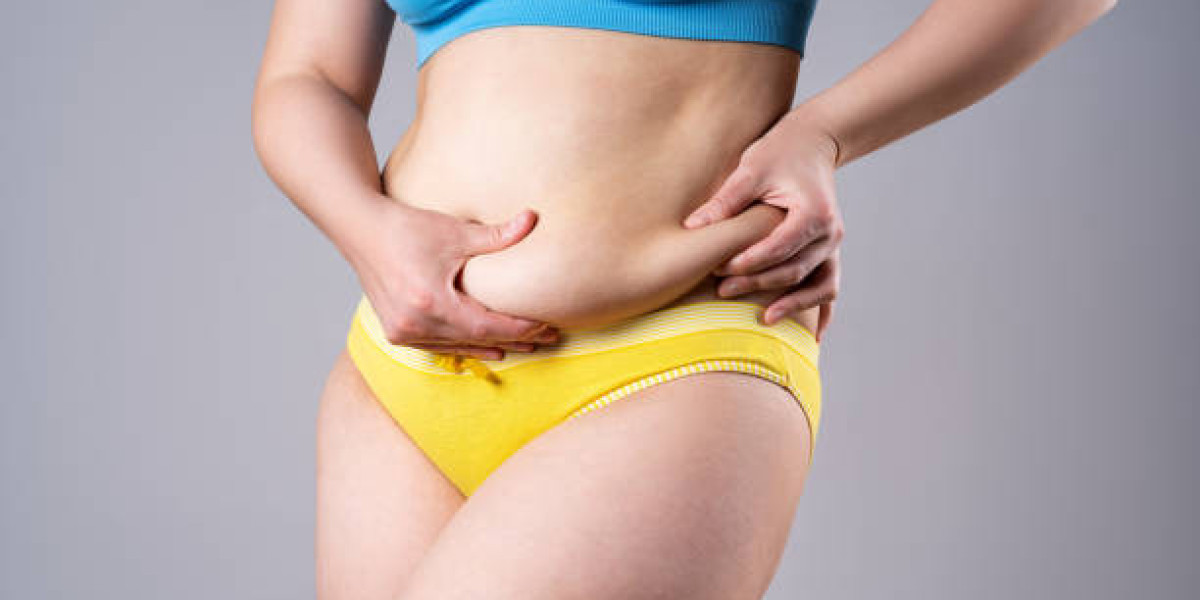 The Ultimate Liposuction in Riyadh FAQ Guide