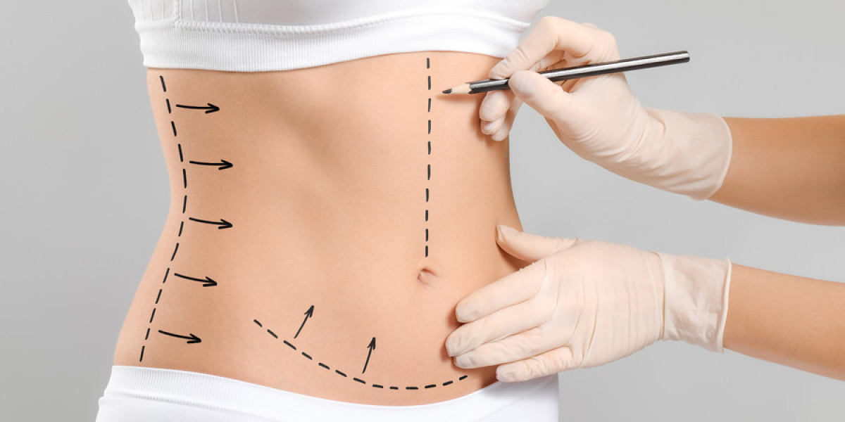 Liposuction vs non-surgical fat reduction options in Islamabad