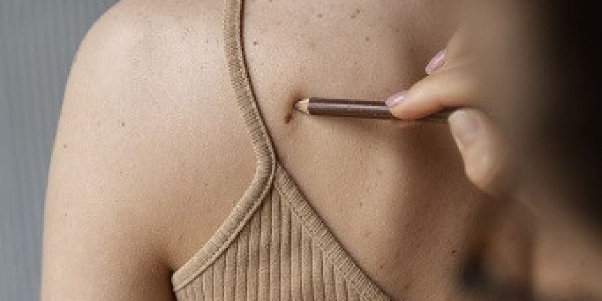 How to Treat Back Acne and Improve Skin Texture