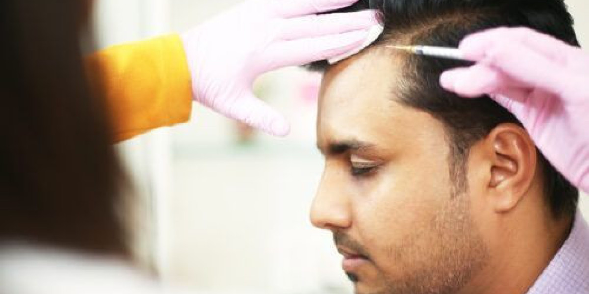 Affordable PRP Hair Riyadh