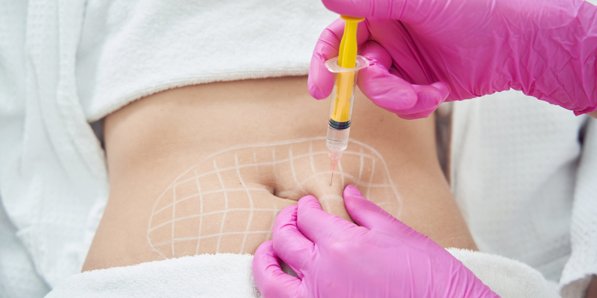 Fat melting injection vs liposuction: Islamabad perspective