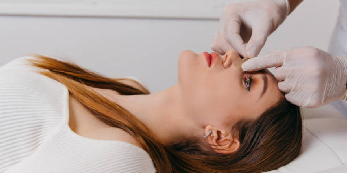 Top 5 Questions to Ask Your Riyadh Rhinoplasty Surgeon