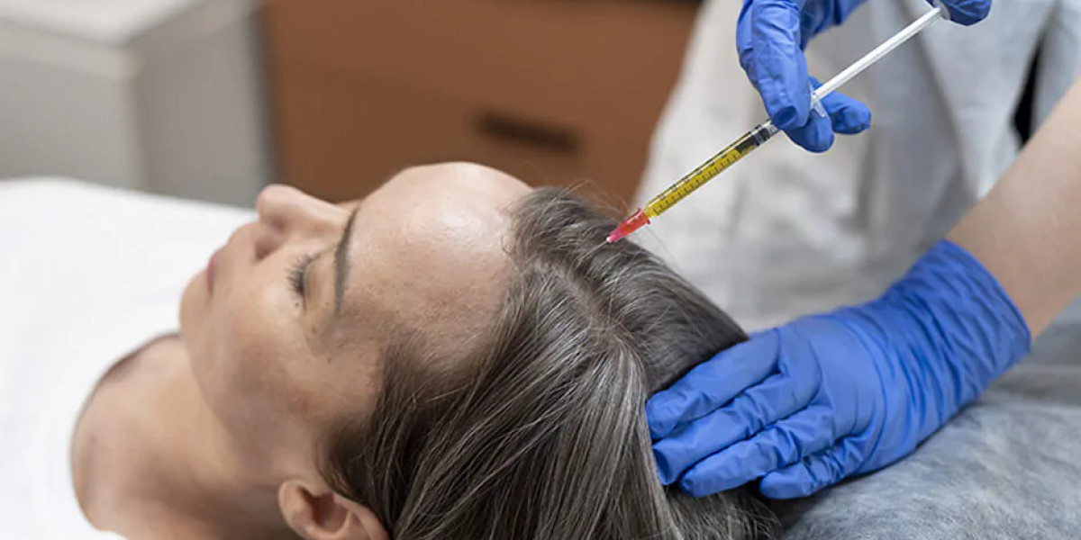 PRP Hair Treatment Cost and Its Role in Natural Hair Restoration