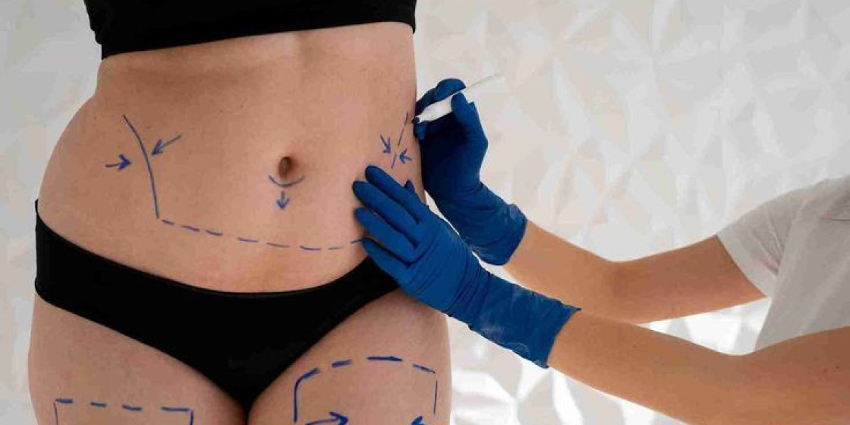 Expert Fat Sculpting Riyadh