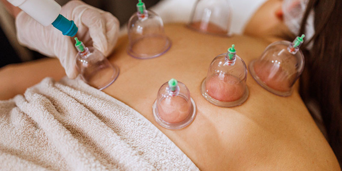 What to Expect During Your First Hijama Treatment