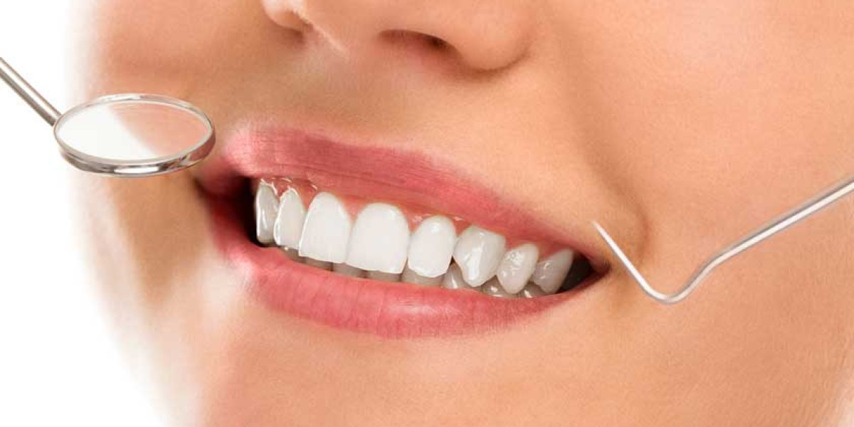Discover the Secret to a Radiant Smile with Teeth Whitening