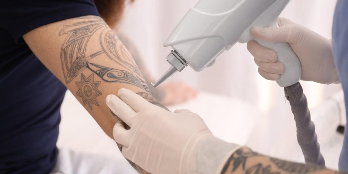 Before and After Care Tips for Tattoo Removal in Islamabad