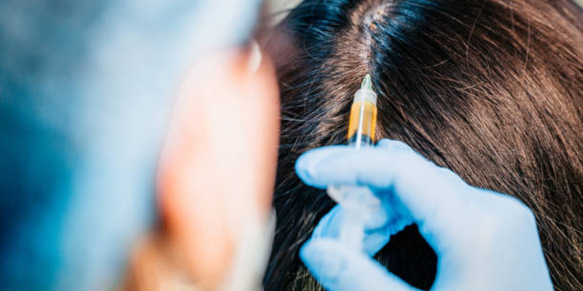PRP Hair Treatment in Riyadh Success Stories from Local Patients