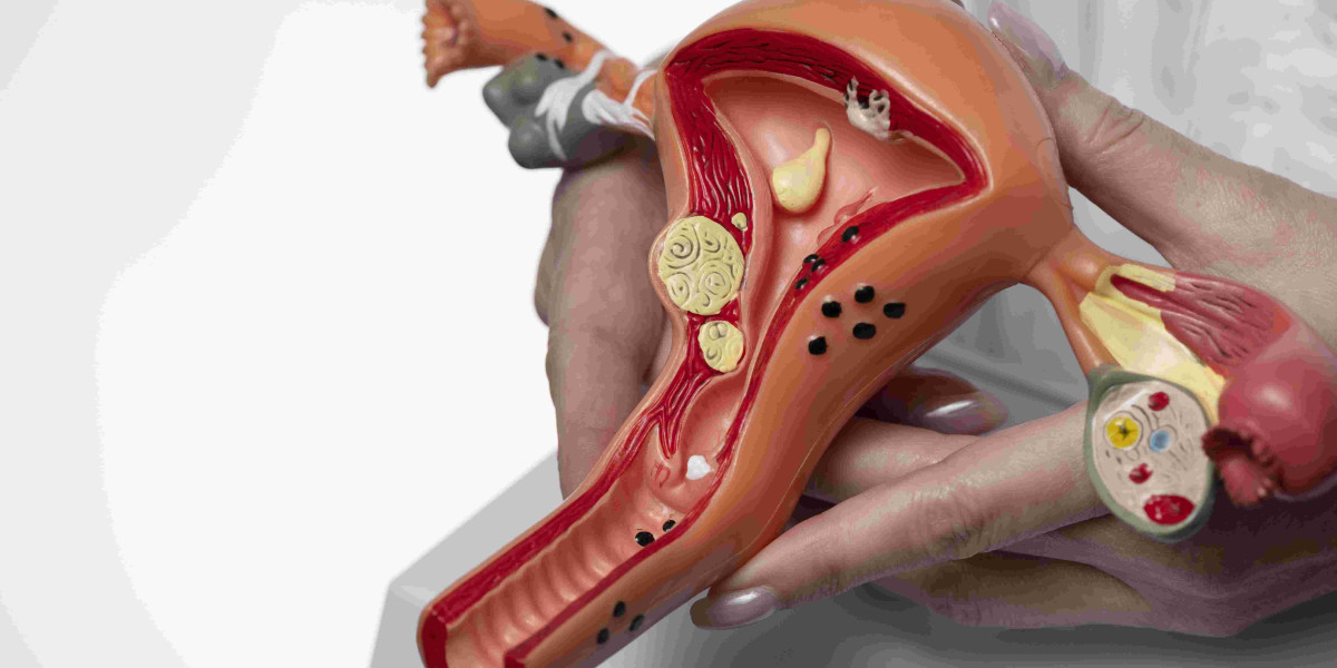 Widespread Medical Reasons That Call for Hysterectomy