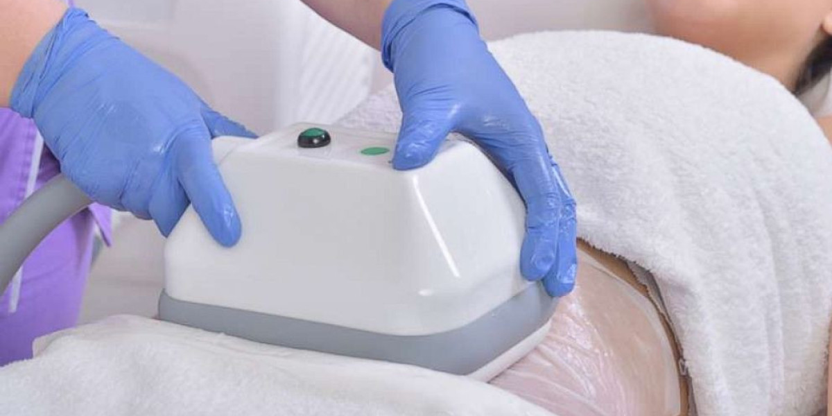 CoolSculpting: The Smart Choice for Non-Surgical Fat Reduction