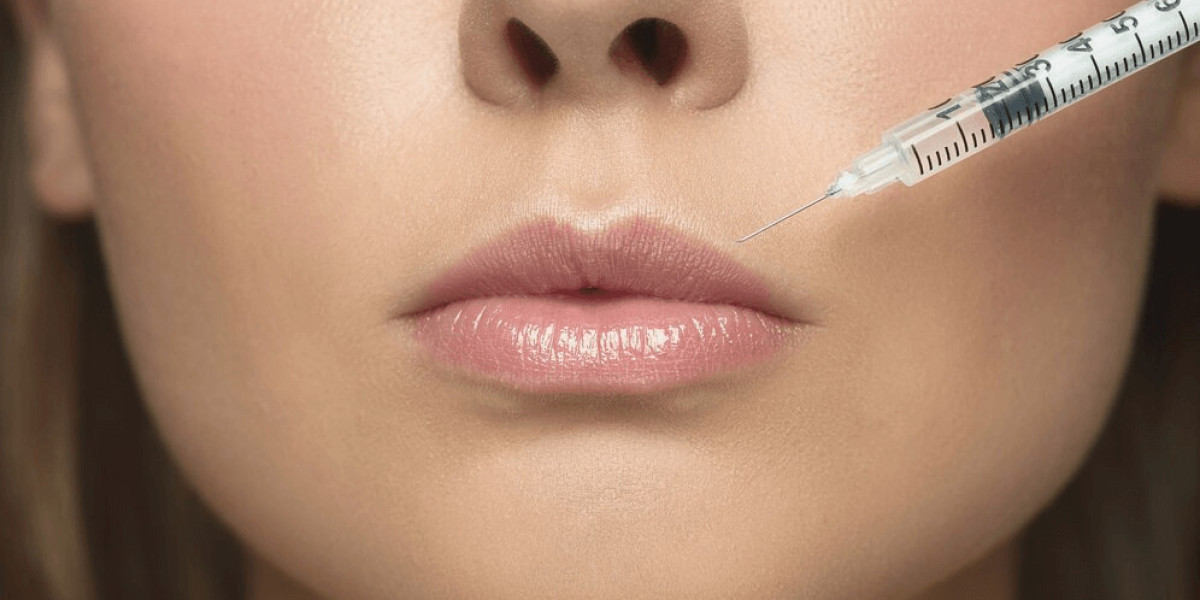 How Lip Fillers Injections Can Improve Your Facial Balance