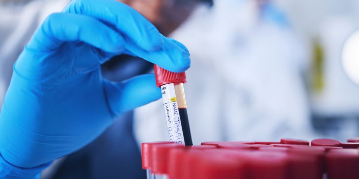 Track Your Hemoglobin Levels with Blood Test at Home