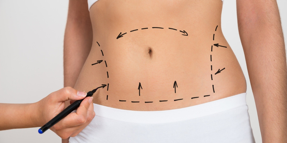 Reclaim Your Confidence with Weight Loss Surgery