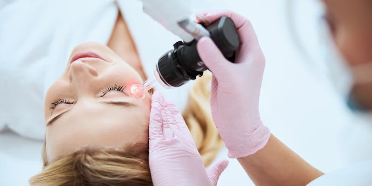 PicoSure Laser Treatment: smart move for complex skin concerns