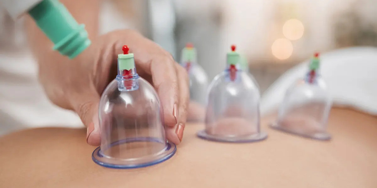 Maximize Inner Balance Daily Through Hijama Cupping Therapy