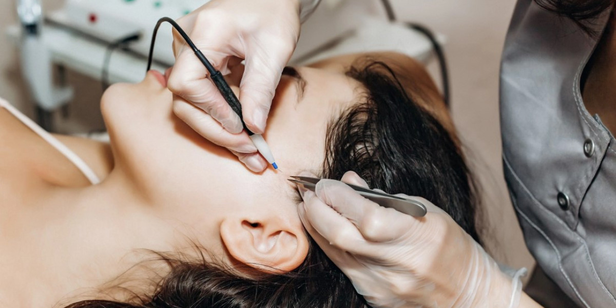 Benefits of Permanent Hair Removal Treatments in Islamabad