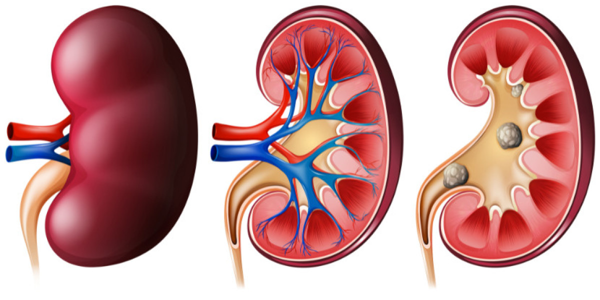 Acute Kidney Injury Treatment Market Size & Report 2034