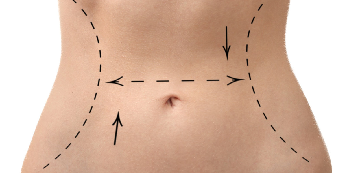 How Liposuction Cost Can Differ Between Clinics