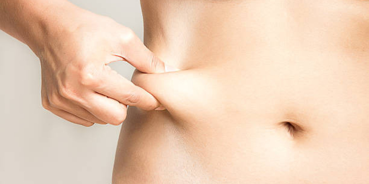 Benefits of Cryolipolysis for Fat Loss