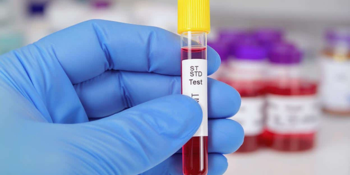 Oral STD Test: What It Detects and How It Works