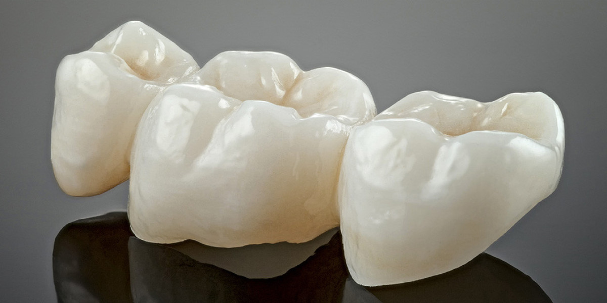 Ceramic Dental Crowns and Bridges: A Natural Look