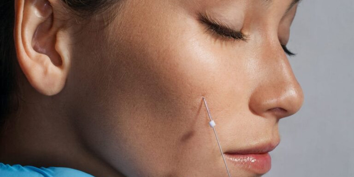 Give Your Face the Boost It Deserves with Thread Lift Treatment