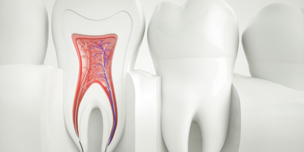 How Root Canal Treatment in Islamabad Helps Save Natural Teeth